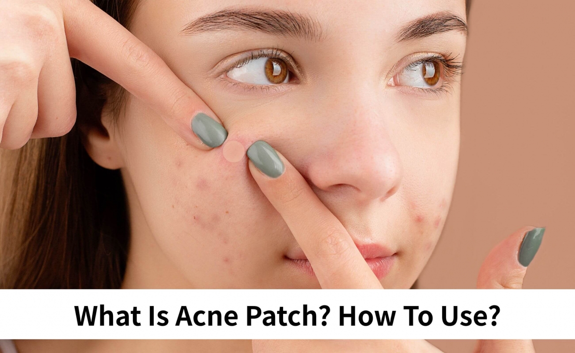 What Is a Acne Patch for Pimple How to Use What Is a Acne Patch for Pimple How to Use