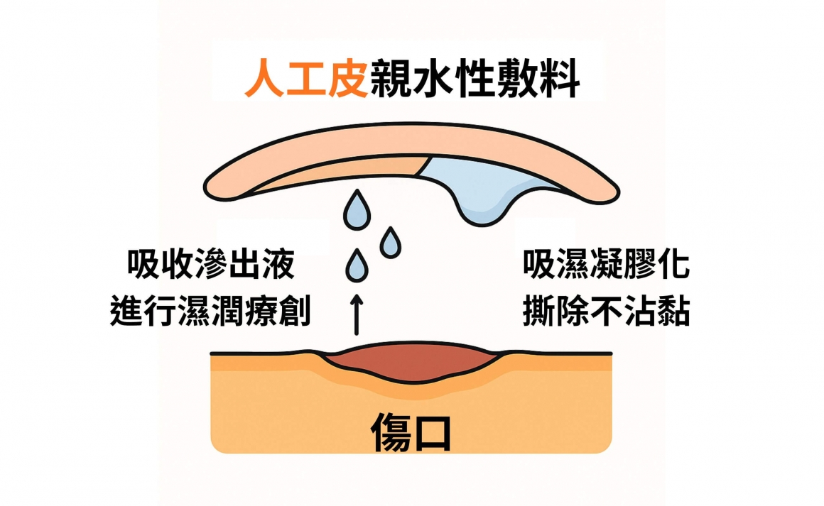 什麼是親水性敷料(人工皮)? 全新生醫 什麼是親水性敷料(人工皮)? 全新生醫